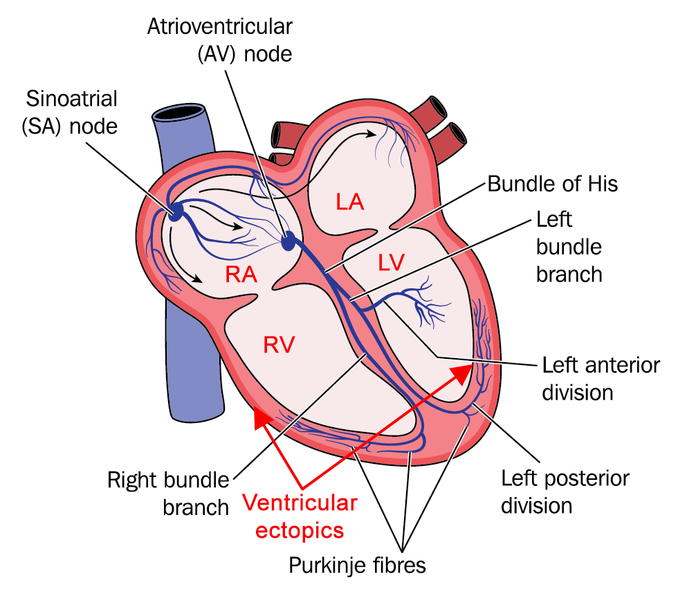 Palpitations: What Are They & When Should You Be Referred? -myHealth bytes