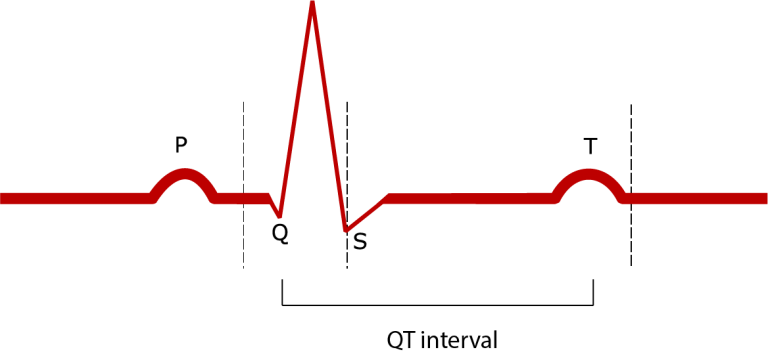 Torsades De Pointes: What Is It, What Causes It and How Is It Treated?